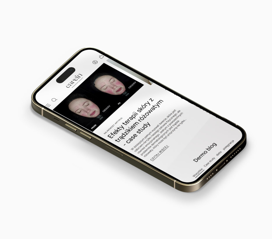 Widoki mobilne sklepu internetowego Carein